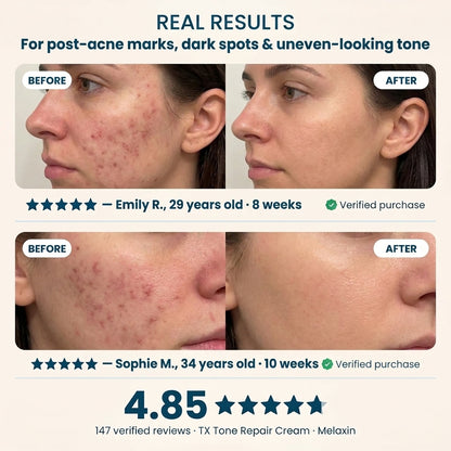 Zentora™ - Tone Repair Cream