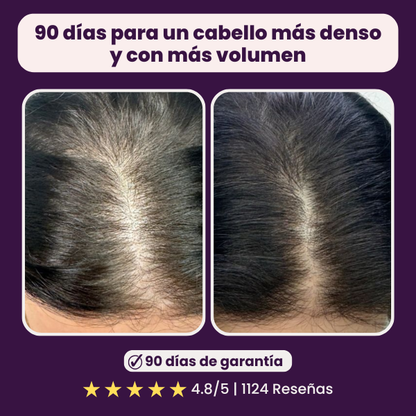 Zentora™ - Apoyo al crecimiento del cabello