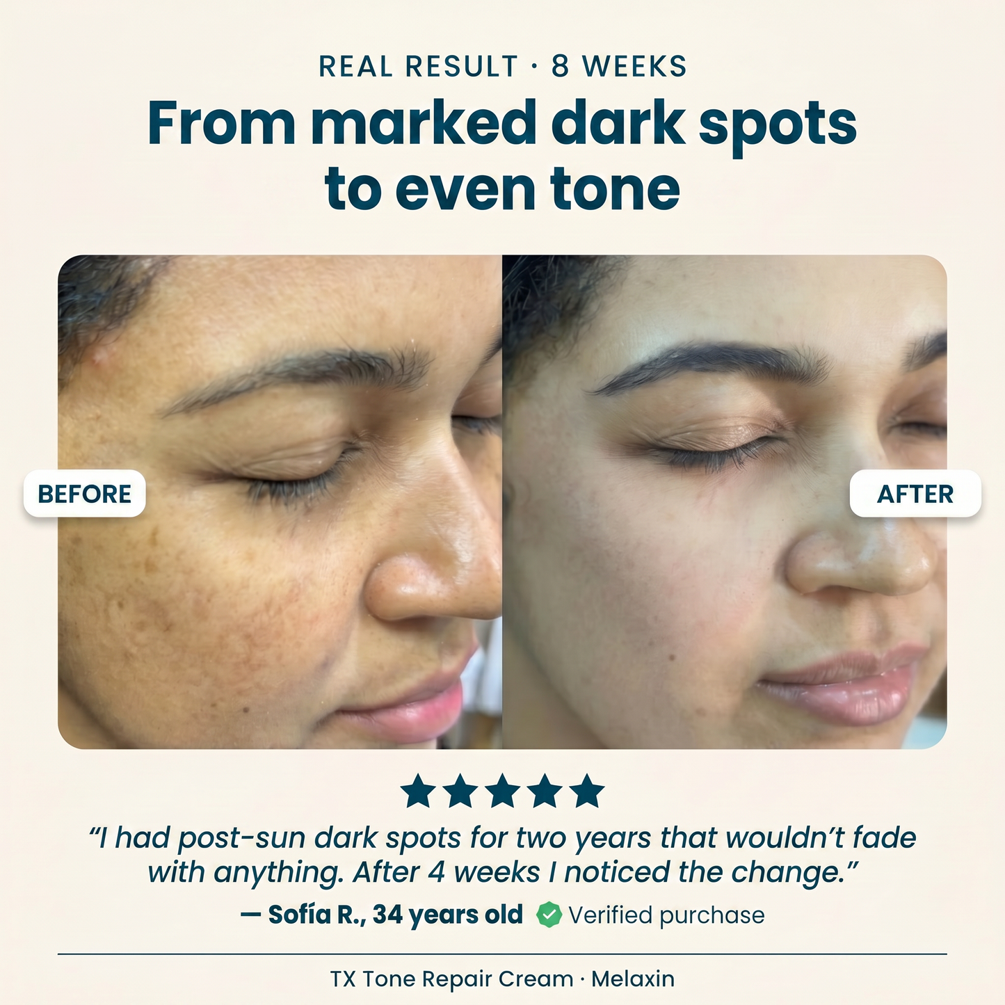 Real result 8 weeks - from marked dark spots to even tone
