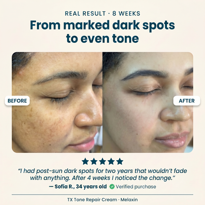 Real result 8 weeks - from marked dark spots to even tone