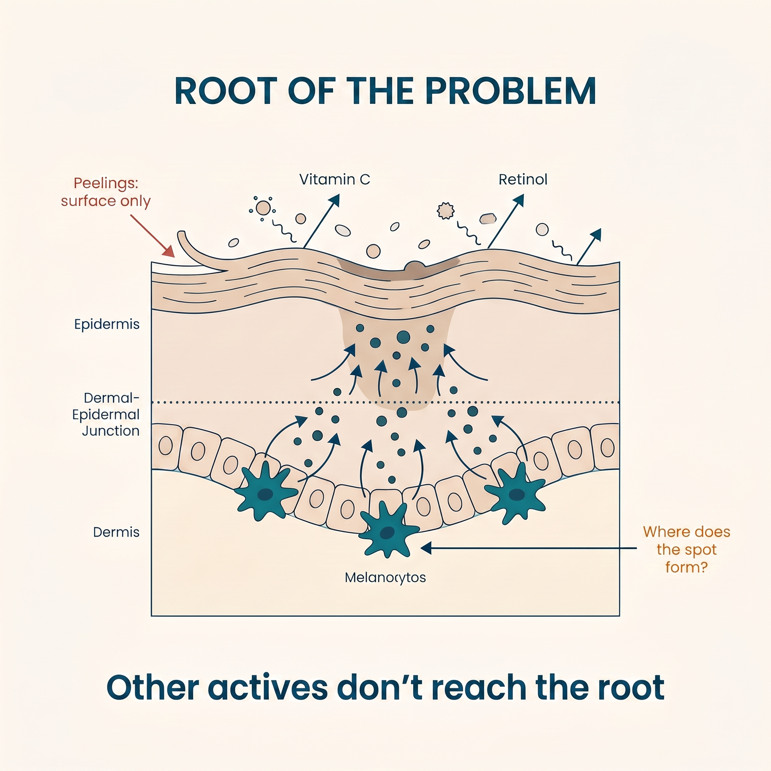 Problem section - English version - TX Tone Repair Cream